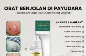 Khasiat dan Manfaat Ace Maxs untuk Benjolan di Payudara